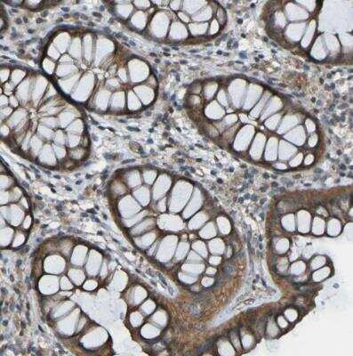 Immunohistochemistry-Paraffin: Lgr5/GPR49 Antibody [NBP2-54660] - Staining of human colon shows cytoplasmic positivity in glandular cells.