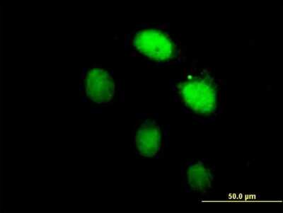 Immunocytochemistry/Immunofluorescence: Lhx4 Antibody [H00089884-B01P] - Analysis of purified antibody to LHX4 on HeLa cell. (antibody concentration 10 ug/ml)