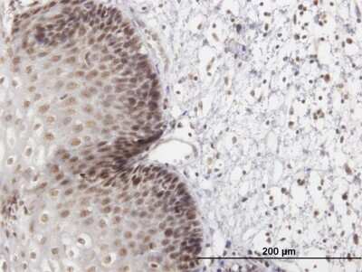 Immunohistochemistry-Paraffin: Lhx4 Antibody [H00089884-B01P] - Analysis of purified antibody to LHX4 on formalin-fixed paraffin-embedded human esophagus. (antibody concentration 3 ug/ml)