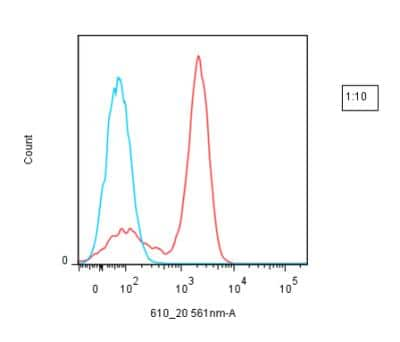 Unknown Lightning-Link (R) Rapid DyLight 594 Antibody Labeling Kit