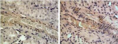 Immunohistochemistry-Paraffin: Limitin/IFN-zeta Antibody (RM0123-7D19) [NBP2-12426] - The Kidney tissue samples from the Folic Acid induced kidney injury model were fixed using 4% PFA at 4C for overnight and embeded in paraffin. 4um section was sublected to IHC with NBP2-12426