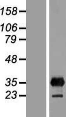 Western Blot: Lin28B Overexpression Lysate (Adult Normal) [NBP2-08934] Left-Empty vector transfected control cell lysate (HEK293 cell lysate); Right -Over-expression Lysate for Lin28B.