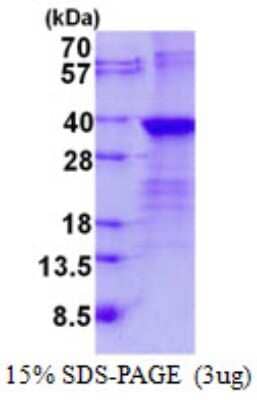 SDS-Page: Lin28B Protein [NBP2-23196]