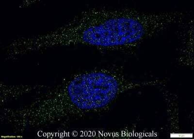 Immunocytochemistry/Immunofluorescence: Lipase A Antibody [NBP1-54155] - HeLa cells were fixed in 4% paraformaldehyde for 10 minutes and permeabilized in 0.05% Triton X-100 in PBS for 5 minutes. The cells were incubated with anti-Lipase A Antibody NBP1-54155 at 2 ug/ml overnight at 4C and detected with an anti-mouse Dylight 488 (Green) at a 1:1000 dilution for 60 minutes. Nuclei were counterstained with DAPI (Blue). Cells were imaged using a 100X objective and digitally deconvolved.