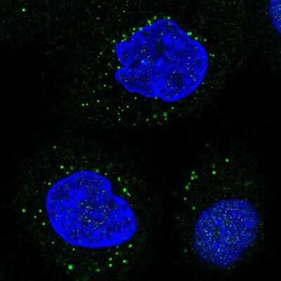 Immunocytochemistry/Immunofluorescence: Lipase A Antibody [NBP2-47397] - Staining of human cell line A-431 shows localization to vesicles. Antibody staining is shown in green.