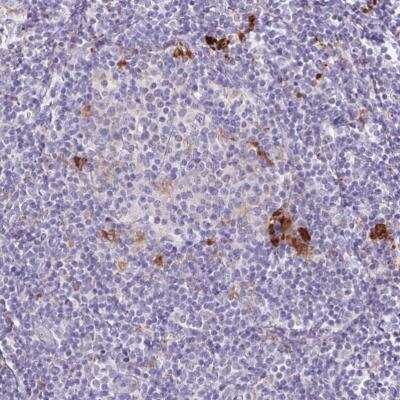 Immunohistochemistry-Paraffin: Lipase A Antibody [NBP2-47397] - Staining of human lymphoid tissues shows strong cytoplasmic positivity in a subset of non-germinal center cells.