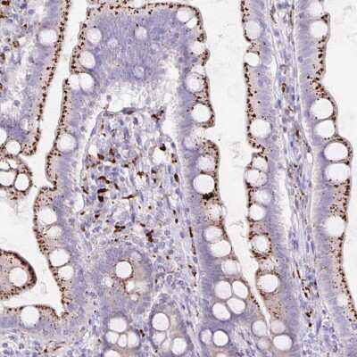 Immunohistochemistry-Paraffin: Lipase A Antibody [NBP2-47397] - Staining of human duodenum shows strong granular cytoplasmic positivity in glandular cells.