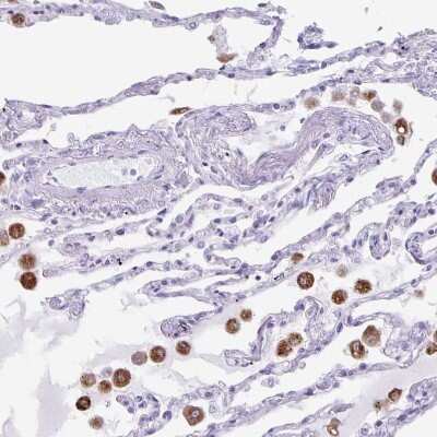 Immunohistochemistry-Paraffin: Lipase A Antibody [NBP2-47397] - Staining of human lung shows moderate cytoplasmic positivity in macrophages.