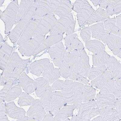 Immunohistochemistry-Paraffin: Lipase A Antibody [NBP2-47397] - Staining of human skeletal muscle shows no positivity in myocytes as expected.