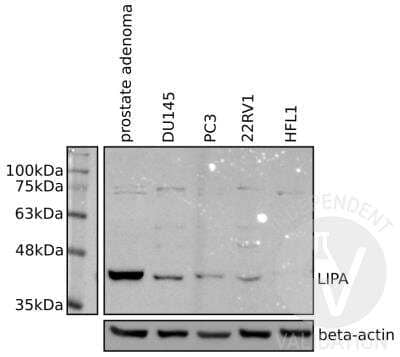 Western Blot Lipase A Antibody - BSA Free