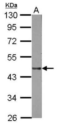 Western Blot: Lipase A Antibody [NBP2-19360] - Sample (50 ug of whole cell lysate) A: Mouse Liver, 10% SDS PAGE gel, diluted at 1:1000.