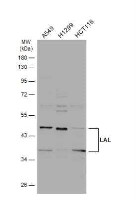 Western Blot: Lipase A Antibody [NBP2-19360] - Various whole cell extracts (30 ug) were separated by 10% SDS-PAGE, and the membrane was blotted with LAL antibody [N3C3] diluted at 1:1000. The HRP-conjugated anti-rabbit IgG antibody (NBP2-19301) was used to detect the primary antibody.w