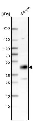 <b>Orthogonal Strategies Validation. </b>Western Blot: Lipase A Antibody [NBP2-47397] - Analysis in human spleen tissue.