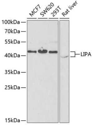 Western Blot: Lipase A Antibody [NBP3-03229] - Analysis of extracts of various cell lines, using Lipase A antibody at 1:1000 dilution. Secondary antibody: HRP Goat Anti-Rabbit IgG (H+L) at 1:10000 dilution. Lysates/proteins: 25ug per lane. Blocking buffer: 3% nonfat dry milk in TBST. Detection: ECL Enhanced Kit.