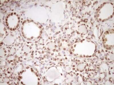 Immunohistochemistry: Lipin 1 Antibody (8F10) [NBP2-45670] - Analysis of Human Kidney tissue. (Heat-induced epitope retrieval by 1 mM EDTA in 10mM Tris, pH8.5, 120C for 3min)