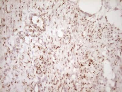 Immunohistochemistry: Lipin 1 Antibody (8F10) [NBP2-45670] - Analysis of Human endometrium tissue. (Heat-induced epitope retrieval by 1 mM EDTA in 10mM Tris, pH8.5, 120C for 3min)