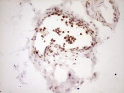 Immunohistochemistry: Lipin 1 Antibody (8F10) [NBP2-45670] - Analysis of Human bladder tissue. (Heat-induced epitope retrieval by 1 mM EDTA in 10mM Tris, pH8.5, 120C for 3min)