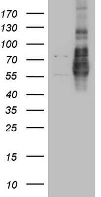 Western Blot: Lipin 1 Antibody (8F10) [NBP2-45670] - Analysis of HEK293T cells were transfected with the pCMV6-ENTRY control (Left lane) or pCMV6-ENTRY Lipin 1.