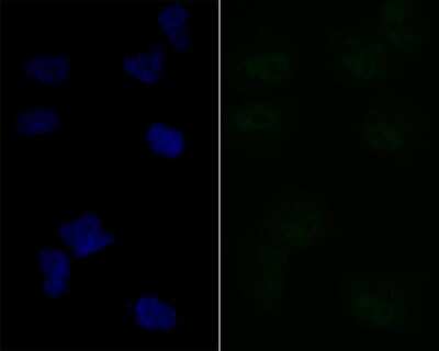 Immunocytochemistry/Immunofluorescence: Lipin 1 Antibody (JG37-69) [NBP2-76845] - ICC staining Lipin 1 in HUVEC cells (green). The nuclear counter stain is DAPI (blue). Cells were fixed in paraformaldehyde, permeabilised with 0.25% Triton X100/PBS.