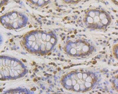 Immunohistochemistry: Lipin 1 Antibody (JG37-69) [NBP2-76845] - Immunohistochemical analysis of paraffin-embedded human colon tissue using anti-Lipin 1 antibody. Counter stained with hematoxylin.