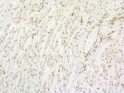 Immunohistochemistry: Lipin 1 Antibody (JG37-69) [NBP2-76845] - Immunohistochemical analysis of paraffin-embedded human skeletal muscle tissue using anti-Lipin 1 antibody. Counter stained with hematoxylin.