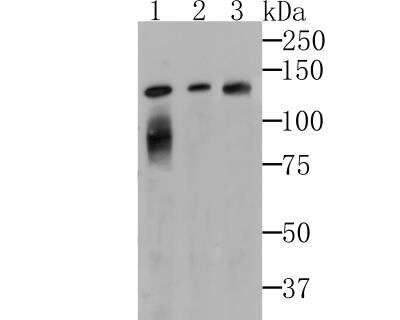 Western Blot: Lipin 1 Antibody (JG37-69) [NBP2-76845] - Western blot analysis of Lipin 1 on different cell lysates using anti-Lipin 1 at 1/500 dilution.Positive control:Line 1: K562 Line 2: SH-SY-5YLine 3: Mouse lung