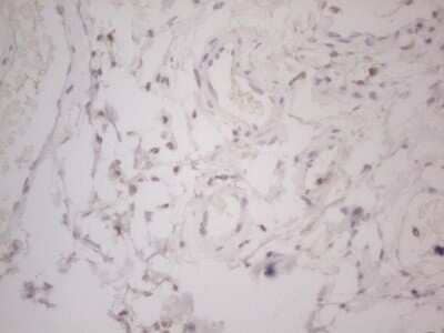 Immunohistochemistry: Lipin 1 Antibody (OTI5B5) - Azide and BSA Free [NBP2-71727] - Analysis of Human bladder tissue. (Heat-induced epitope retrieval by Tris-EDTA, pH8.0)