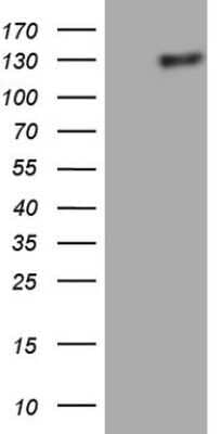 Western Blot: Lipin 1 Antibody (OTI5B5) - Azide and BSA Free [NBP2-71727] - Analysis of HEK293T cells were transfected with the pCMV6-ENTRY control (Left lane) or pCMV6-ENTRY Lipin 1.