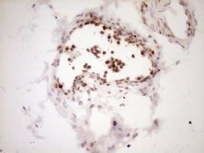 Immunohistochemistry: Lipin 1 Antibody (OTI8F10) - Azide and BSA Free [NBP2-71726] - Analysis of Human bladder tissue. (Heat-induced epitope retrieval by 1 mM EDTA in 10mM Tris, pH8.5, 120C for 3min)