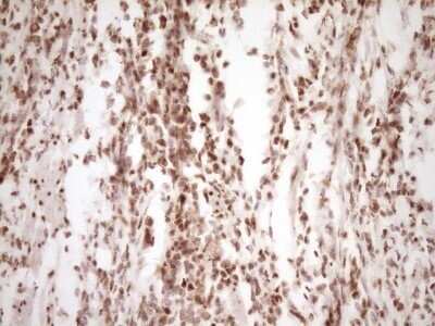 Immunohistochemistry: Lipin 1 Antibody (OTI8F10) - Azide and BSA Free [NBP2-71726] - Analysis of Human colon tissue. (Heat-induced epitope retrieval by 1 mM EDTA in 10mM Tris, pH8.5, 120C for 3min)