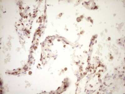 Immunohistochemistry: Lipin 1 Antibody (OTI8F10) - Azide and BSA Free [NBP2-71726] - Analysis of Human lung tissue. (Heat-induced epitope retrieval by 1 mM EDTA in 10mM Tris, pH8.5, 120C for 3min)