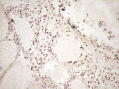 Immunohistochemistry: Lipin 1 Antibody (OTI8F10) - Azide and BSA Free [NBP2-71726] - Analysis of Human lymph node tissue. (Heat-induced epitope retrieval by 1 mM EDTA in 10mM Tris, pH8.5, 120C for 3min)