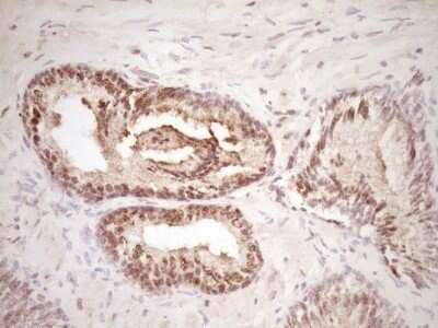 Immunohistochemistry: Lipin 1 Antibody (OTI8F10) - Azide and BSA Free [NBP2-71726] - Analysis of Human prostate tissue. (Heat-induced epitope retrieval by 1 mM EDTA in 10mM Tris, pH8.5, 120C for 3min)