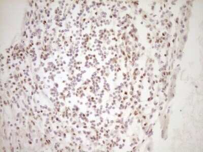 Immunohistochemistry: Lipin 1 Antibody (OTI8F10) - Azide and BSA Free [NBP2-71726] - Analysis of Human thyroid tissue. (Heat-induced epitope retrieval by 1 mM EDTA in 10mM Tris, pH8.5, 120C for 3min)