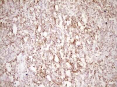 Immunohistochemistry: Lipin 1 Antibody (OTI8F10) - Azide and BSA Free [NBP2-71726] - Analysis of Human tonsil tissue. (Heat-induced epitope retrieval by 1 mM EDTA in 10mM Tris, pH8.5, 120C for 3min)