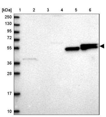 Western Blot: Lipin 1 Antibody [NBP1-83030] - Lane 1: Marker  [kDa] 250, 130, 95, 72, 55, 36, 28, 17, 10.  Lane 2: Human cell line RT-4.  Lane 3: Human cell line U-251MG sp.  Lane 4: Human plasma (IgG/HSA depleted).  Lane 5: Human liver tissue.  Lane 6: Human tonsil tissue