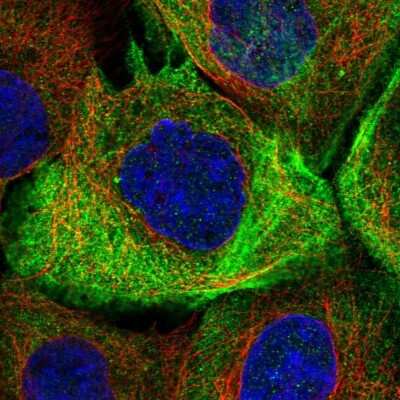 Immunocytochemistry/Immunofluorescence: Lipin 2 Antibody [NBP2-33931] - Immunofluorescent staining of human cell line A-431 shows localization to plasma membrane, cytosol & actin filaments.