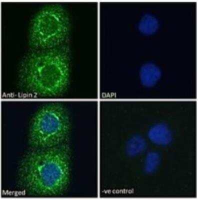 Immunocytochemistry/Immunofluorescence: Lipin 2 Antibody [NBP3-00525] - Immunofluorescence analysis of paraformaldehyde fixed A431 cells, permeabilized with 0.15% Triton. Primary incubation 1hr (10ug/ml) followed by Alexa Fluor (TM) 488 secondary antibody (2ug/ml), showing cytoplasmic staining. The nuclear stain is DAPI (blue). Negative control: Unimmunized goat IgG (10ug/ml) followed by Alexa Fluor (TM) 488 secondary antibody (2ug/ml).