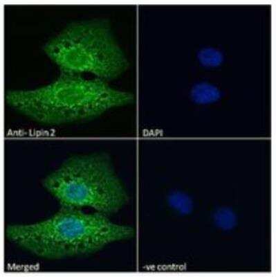 Immunocytochemistry/Immunofluorescence: Lipin 2 Antibody [NBP3-00525] - Immunofluorescence analysis of paraformaldehyde fixed U2OS cells, permeabilized with 0.15% Triton. Primary incubation 1hr (10ug/ml) followed by Alexa Fluor (TM) 488 secondary antibody (2ug/ml), showing cytoplasmic staining. The nuclear stain is DAPI (blue). Negative control: Unimmunized goat IgG (10ug/ml) followed by Alexa Fluor (TM) 488 secondary antibody (2ug/ml).