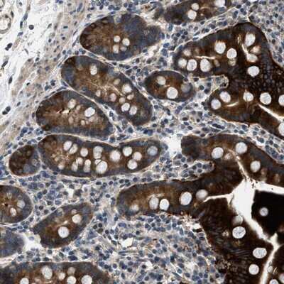 Immunohistochemistry-Paraffin: Lipin 2 Antibody [NBP1-87853] - Staining of human duodenum shows strong cytoplasmic positivity in glandular cells.