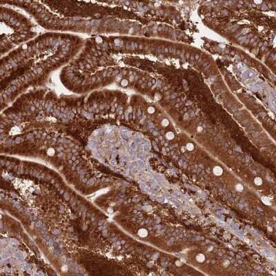 Immunohistochemistry-Paraffin: Lipin 2 Antibody [NBP2-33931] - Staining of human duodenum shows high expression.