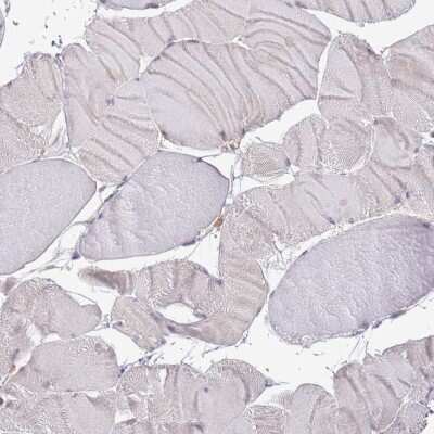 Immunohistochemistry-Paraffin: Lipin 2 Antibody [NBP2-33931] - Staining of human skeletal muscle shows low expression as expected.