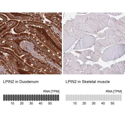 <b>Orthogonal Strategies Validation. </b>Immunohistochemistry-Paraffin: Lipin 2 Antibody [NBP2-33931] - Staining in human duodenum and skeletal muscle tissues using anti-LPIN2 antibody. Corresponding LPIN2 RNA-seq data are presented for the same tissues.