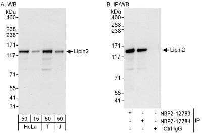 Immunoprecipitation: Lipin 2 Antibody [NBP2-12783] - Samples: Whole cell lysate from HeLa (15 and 50 ug for WB; 1 mg for IP, 20% of IP loaded), 293T (T; 50 ug) and Jurkat (J; 50 ug) cells. Antibodies: Affinity purified rabbit anti-Lipin2 antibody NBP2-12783 used for WB at 0.1 ug/ml (A) and 1 ug/ml (B) and used for IP at 6 ug/mg lysate. Lipin2 was also immunoprecipitated by rabbit anti-Lipin2 antibody NBP2-12784, which recognizes a downstream epitope. Detection: Chemiluminescence with exposure times of 30 seconds (A) and 10 seconds (B).