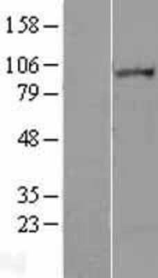 Western Blot: Lipin 2 Overexpression Lysate (Adult Normal) [NBL1-12654] Left-Empty vector transfected control cell lysate (HEK293 cell lysate); Right -Over-expression Lysate for Lipin 2.