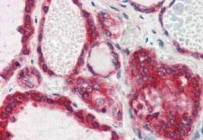 Immunohistochemistry-Paraffin: Lipin 3 Antibody [NB100-53802] - (2.5ug/ml) staining of paraffin embedded Human Thyroid Gland. Steamed antigen retrieval with citrate buffer pH 6, AP-staining.