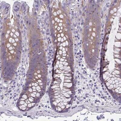 Immunohistochemistry-Paraffin: Lipin 3 Antibody [NBP2-31920] - Staining of human colon shows moderate cytoplasmic positivity in glandular cells.