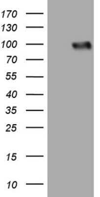 Western Blot: Lipin 3 Antibody (OTI1D7) - Azide and BSA Free [NBP2-72160] - Analysis of HEK293T cells were transfected with the pCMV6-ENTRY control (Left lane) or pCMV6-ENTRY Lipin 3.