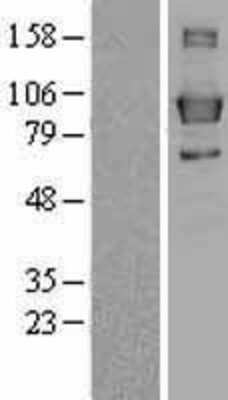 Western Blot: Lipin 3 Overexpression Lysate (Adult Normal) [NBL1-12655] Left-Empty vector transfected control cell lysate (HEK293 cell lysate); Right -Over-expression Lysate for Lipin 3.