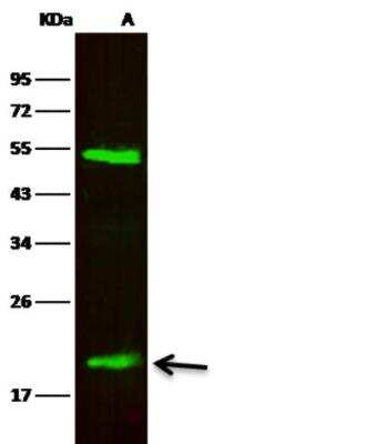Western Blot: Lipocalin-2/NGAL Antibody (128) [NBP2-89346] - Lane A: Jurkat Whole Cell Lysate Lysates/proteins at 30 ug per lane.Secondary Goat Anti-Rabbit IgG H&L (Dylight800) at 1/10000 dilution.Developed using the Odyssey technique. Performed under reducing conditions.Predicted band size:23 kDa Observed band size:23 kDa (We are unsure as to the identity of these extra bands.)
